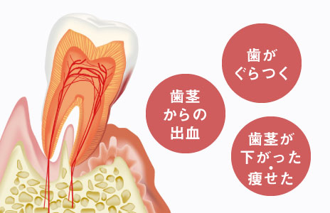 歯がぐらつく／歯茎からの出血／歯茎が下がった・痩せた