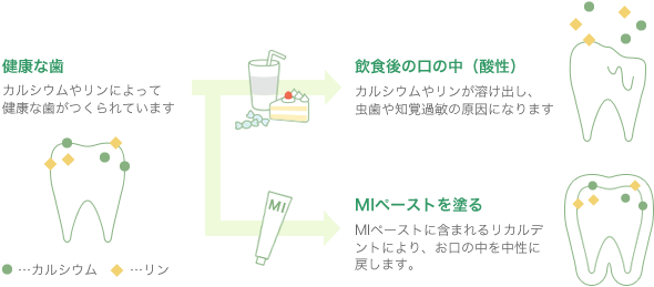 MIパック知覚過敏・虫歯予防