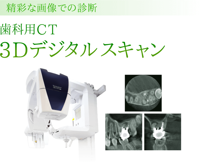 精彩な画像での診断 歯科用CT 3Dデジタルスキャン