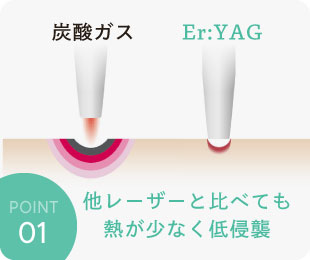 他レーザーと比べても熱が少なく低侵襲