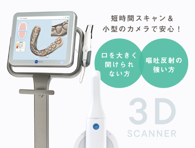 短時間スキャン&小型のカメラで安心!3D光学口腔内スキャナー